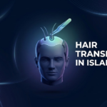 Hair Transplant in Islamabad