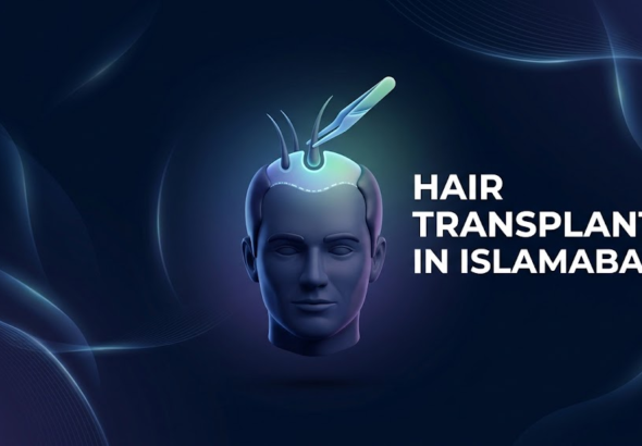 Hair Transplant in Islamabad