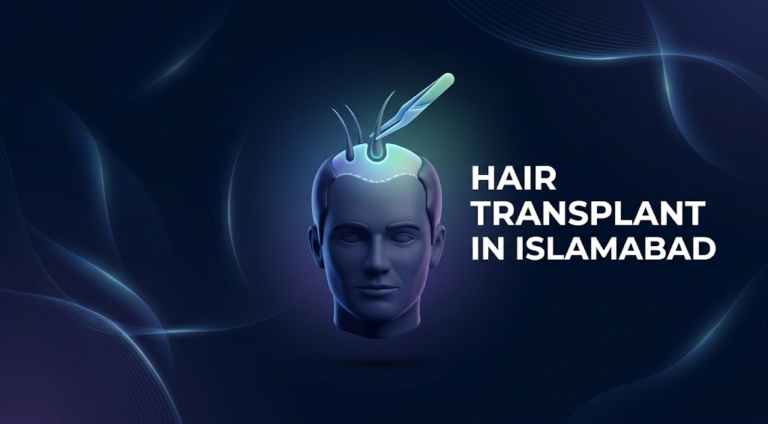 Hair Transplant in Islamabad